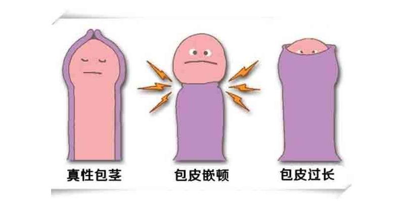 8871562045932341.jpg 3.jpg